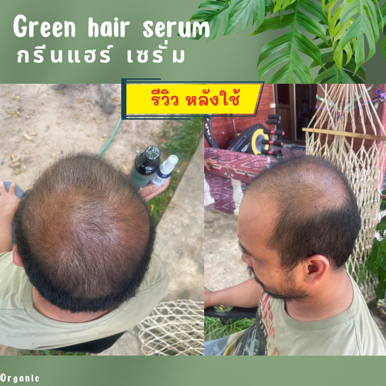 Shampoo Duo Hair & Green Hair Serum ชุดดูแลรากผม